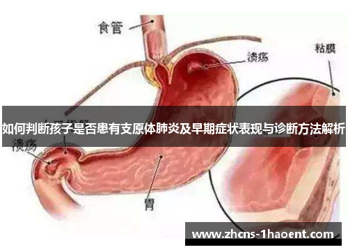 如何判断孩子是否患有支原体肺炎及早期症状表现与诊断方法解析